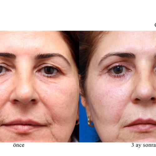 Before after photos of our patients 8